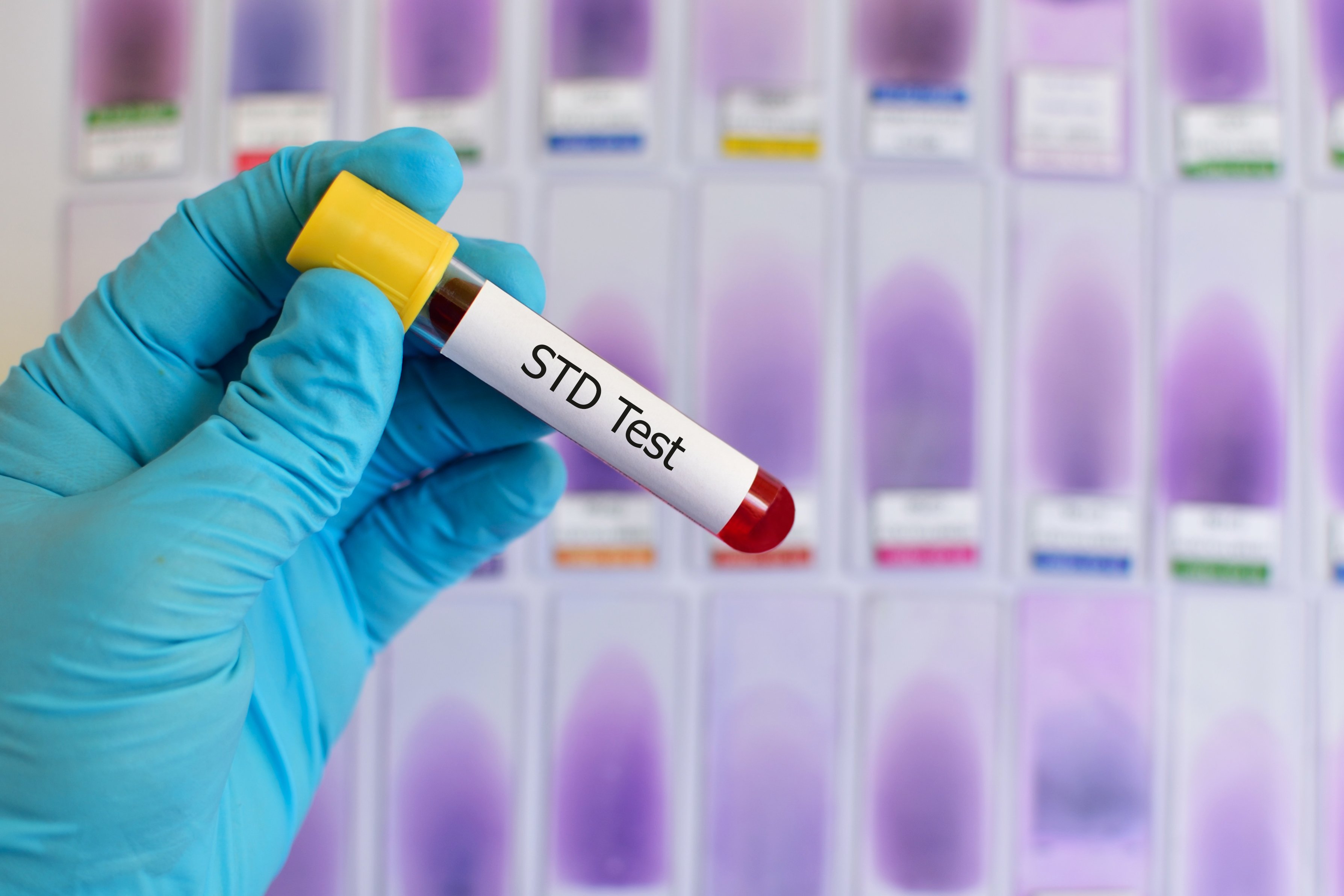 Medical Professional Conducting STD Testing