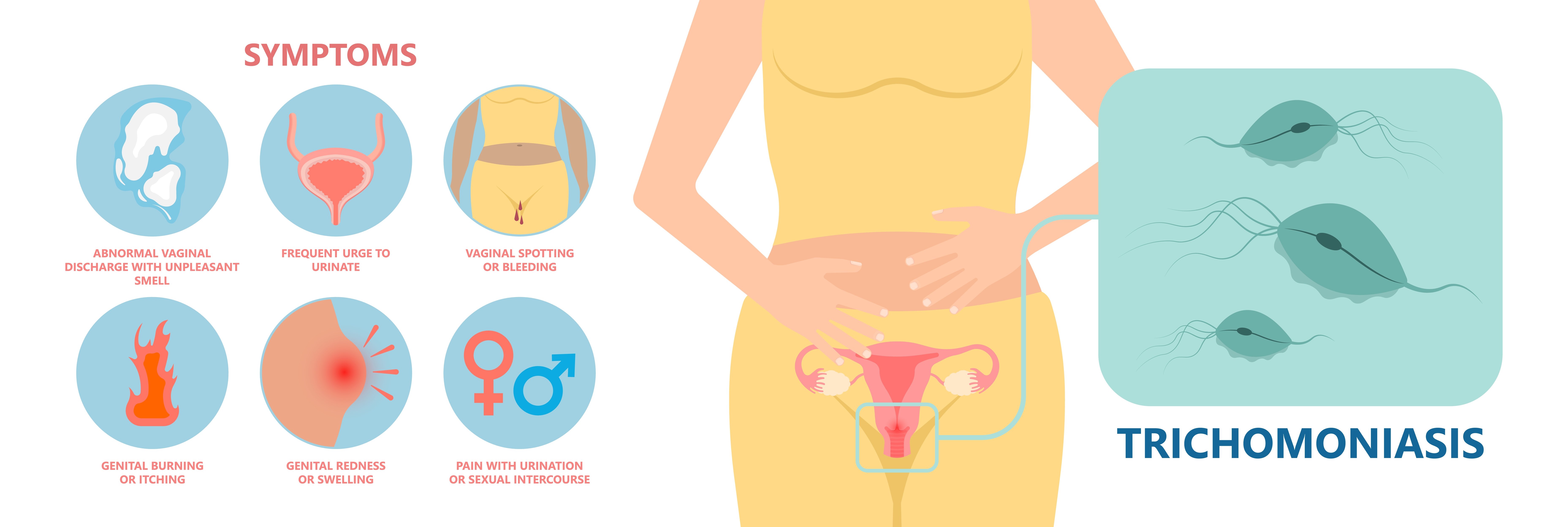 STD Testing: Trichomonas (Trichomoniasis)