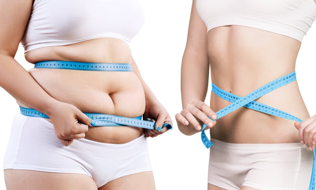 Weight Loss Garden OB GYN Services