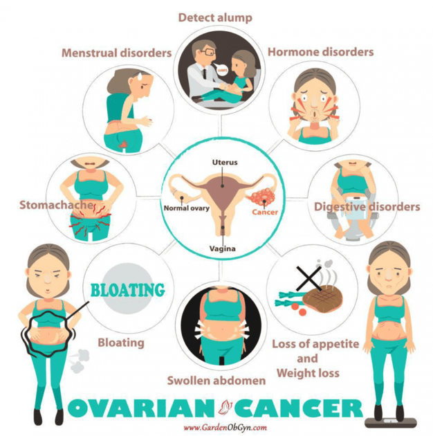 Ovarian Cancer: The Importance Of Recognizing The Symptoms: Garden ...