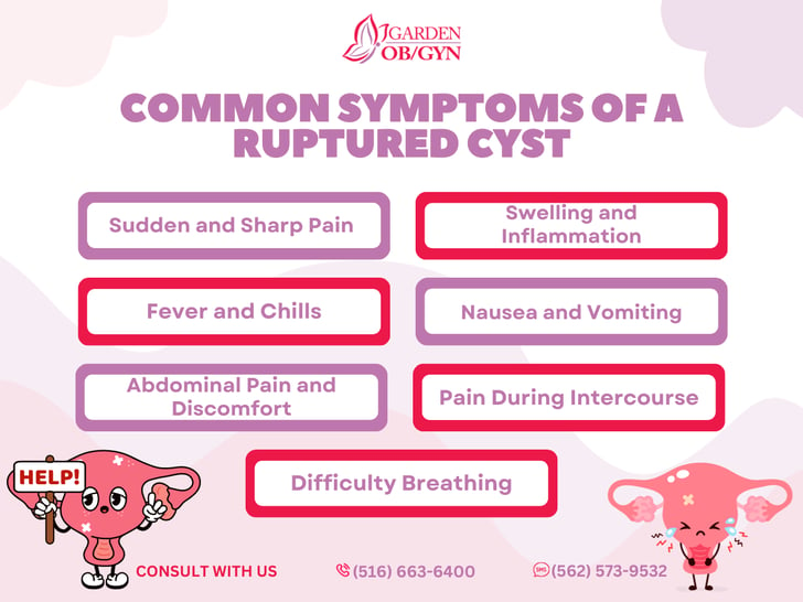 Ovarian Cyst Rupture – symptoms and causes